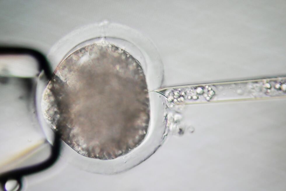 Seen through a microscope, DNA is removed from a pig egg cell near Blacksburg, Va., on May 30,...